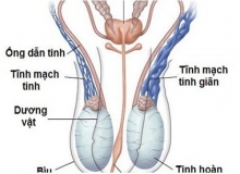 Nang thừng tinh là gì? Nguyên nhân, triệu chứng của bệnh này như thế nào? 